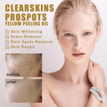 1pcs/2pcs Exfoliator Oil,Yellow Peeling Oil,Rejuvenating And Beautifying The Skin, Deep Cleansing And Removing Dead Skin,Nourish The Body,Body And Facial Care Oil - Màu vàng - Xem 4