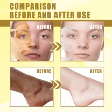 1pcs/2pcs Exfoliator Oil,Yellow Peeling Oil,Rejuvenating And Beautifying The Skin, Deep Cleansing And Removing Dead Skin,Nourish The Body,Body And Facial Care Oil - Màu vàng - Xem 5