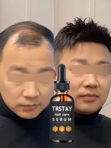 Hair Care Essential Oil Makes Hair More Moisturized, Allowing You To Have A Great Mood All Day - Nhiều màu - Xem 3