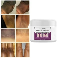 Body Darkening Cream, Removes Darkening From Thigh Joints And Knees, Brightens The Luster Of Joints And Whitens The Skin. Effective Moisturizing, Soothing And Brightening Body Lotion - White - View 1