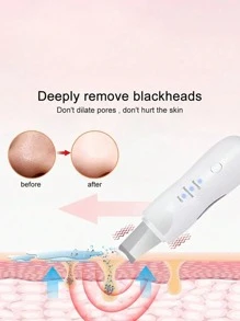 Haut-schaber Gesichts-spatel, Ultraschall-haut-scrubber Gesichtsreinigungs-import & Export-spatelgerät, Gesicht-spatel Haut-spatel Poren-reiniger Mitesser-entfernerwerkzeuge, Für Gesichtstiefenreinigung