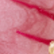 Hồng