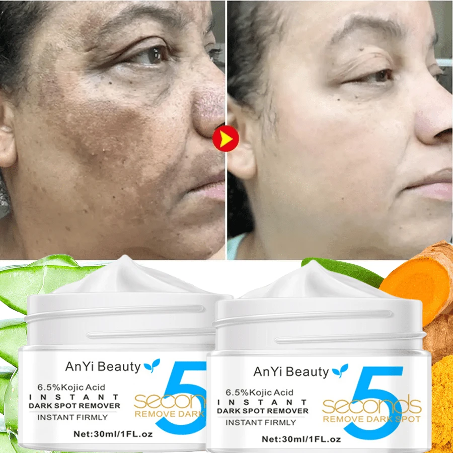 2Pcs Dark Spot Remover For Face And Body, Dark Spot Corrector Cream, Age Spot Sun Spot Freckles Brown Spot Remover, Melasma Treatment For Face, Mild And Non-Irritating, Non-Greasy And Easy To Absorb - Dark Spot Cream - View 1