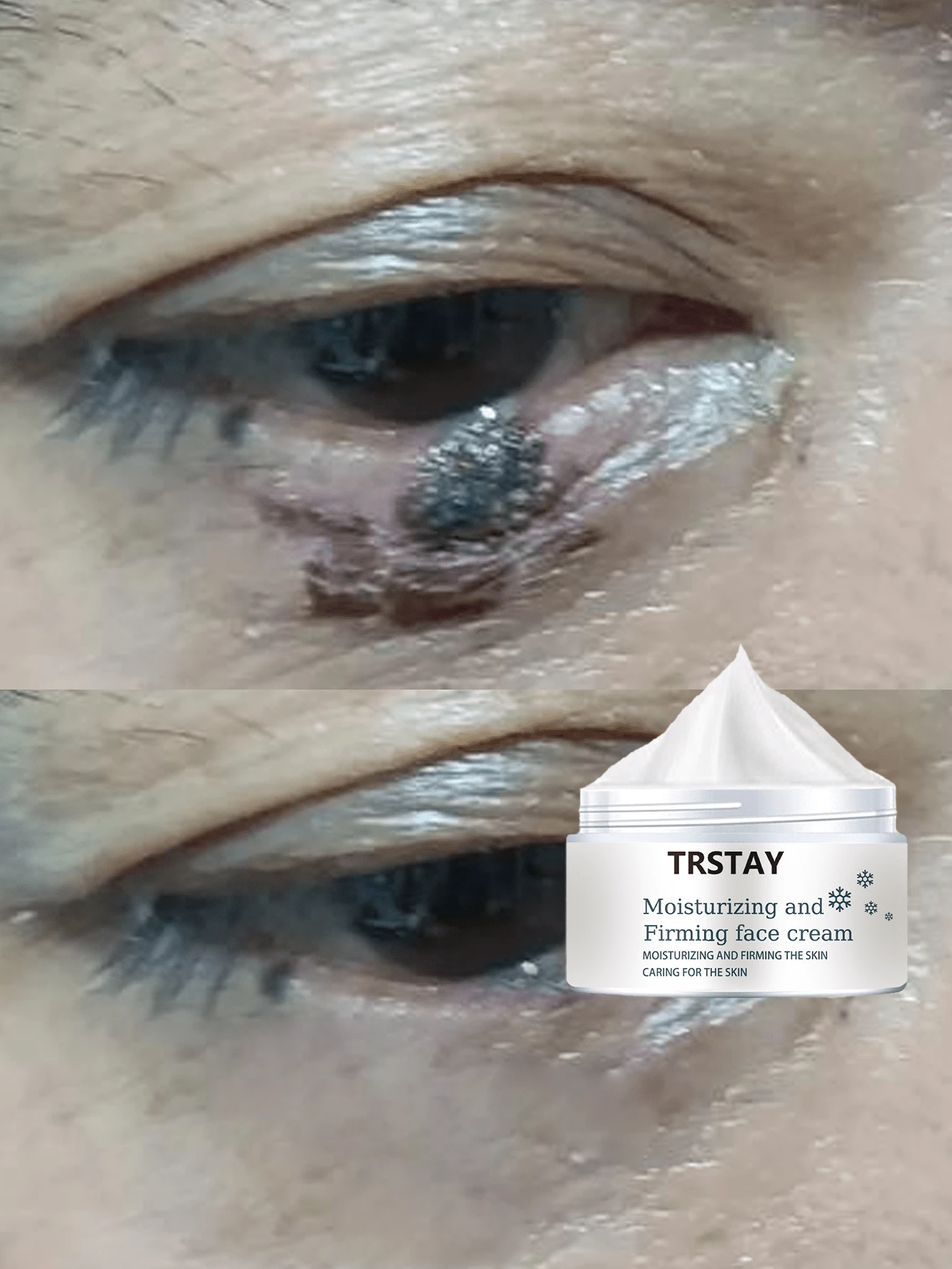 Soft And Smooth Eye Cream Gently Rubs And Disperses Annoying Small Bumps For A Silky Smooth And Glossy Appearance Around The Eyes While Effectively Soothing And Brightening The Delicate Eye Area With Its Nourishing Formula - 彩色 - 查看 1