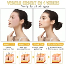Electric Face Hair Remover With Power Display, One-Button Dual-Mode, Type-C Rechargeable Cordless Women's Facial Hair Removal Epilator - Physical Epilation, Prevents Regrowth. Pearl Powder Lubricant Needs To Be Purchased Separately