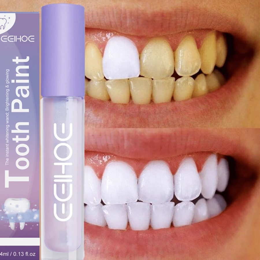 2pcs Teeth Whitening Pen,Tooth Whitening Gel,Travel Suit Tooth Bleach Gel,Stains Personal Oral Hygiene,Gift For Women,Girl And Parents - 紫色 - 查看 1