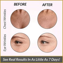 11 Pieces Anti-Wrinkle Silicone Patch For Face, Forehead, Bust And Neck - Clear - View 3