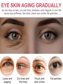 TRSTAY: Contain Essence Collagen, Reduce The Appearance Of Eye Bags, Lift And Eliminate Wrinkles And Fine Lines, Suitable For All Skin Types. - 彩色 - 查看 4