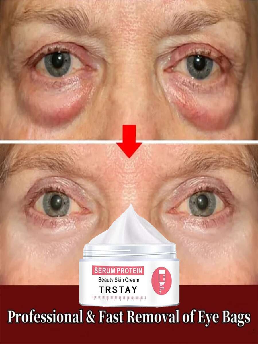 TRSTAY: Contain Essence Collagen, Reduce The Appearance Of Eye Bags, Lift And Eliminate Wrinkles And Fine Lines, Suitable For All Skin Types. - 彩色 - 查看 1