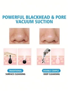 1 Blackhead Remover Pore Vacuum Cleaner, Facial Pore Cleaner, 5 Suction Heads, 3 Suction Forces, Blackhead Remover Pore Vacuum Cleaner USB Rechargeable Facial Pore Cleaner Adult Extraction Tool Multifunctional Cleaning Instructions - Multicolor - View 7