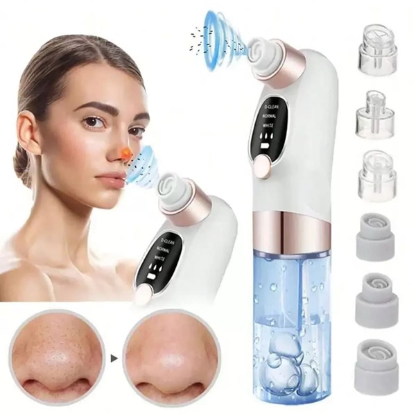 Electric Facial Blackhead Remover, Facial Pore Cleaner And Blackhead Extractor With 3 Adjustable Suction Levels, 6 Probes, USB Charging Port, Suitable For Women And Men, Suitable For Home Use And As Holiday Gifts, 400 MAh Battery Capacity