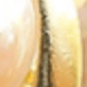 Kẹp tai