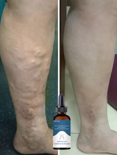 Essential Oil For Legs Tightening Smoothing Moisturizing Slim Look Health Care Multiple Sizes Women Men