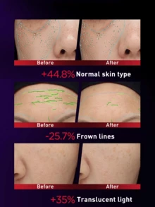 L’Oreal Paris Revita Lift Filler [HA] Pro-Xylane Pro Skincare Set, Trial Size/Full Size 65+50ml/130+110ml, Suitable For All Skin Types, Instantly Hydrates And Softens Skin, Radiant Glow, Moisturizing And Non-Greasy Formula, Easy Absorption, Reduces Fine Lines, All-Day Hydration, Restores Skin Elasticity, Stabilizes Skin Barrier, Ideal For Daily Skincare, Perfect Choice For Anti-Aging Enthusiasts Seeking Effective Wrinkle Reduction And Youthful Radiance - L'Oreal Second Generation Boseiin Water and Milk Set - View 10