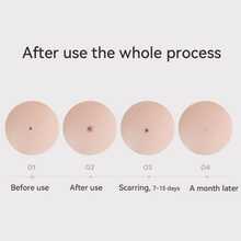 15 Level Laser Plasma Pen Skin Tag Remover Freckle Black Dot Papilloma Warts Mole Pimples Tattoo Removal Beauty Skin Care Tools - Vàng - Xem 6