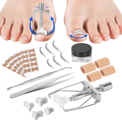 Ingrown Toenail Tre…