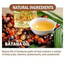 Batana Oil Hair Care Set,Long-Lasting Moisturizing,Reduce Split Ends,Strengthens Hair Roots And Improves Hair Quality, Gently Softens Hair, Nourishes Luster, Repairs And Massages The Scalp,Valentine'S Day Beauty Gift, For Men And Women,Batana Oil Conditioner & Batana Oil Shampoo & Batana Oil Hair Mask & Batana Oil Hair Care Oil - 彩色 - 查看 2