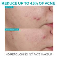 La R-oche Posa Effaclar Serum Ultra Concentrado Anti-Marks 30ml - Peeling Diario para Disminuir Marcas y Mejorar la Textura, Regalo Exclusivo para San Valentín 2025, Uso Continuo, Ideal para Piel Mixta y Sensible - Blanco - Ver 3