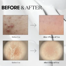 VT Reedle Shot 300 50ML - Face Serum - Hyaluronic Acid - View 7