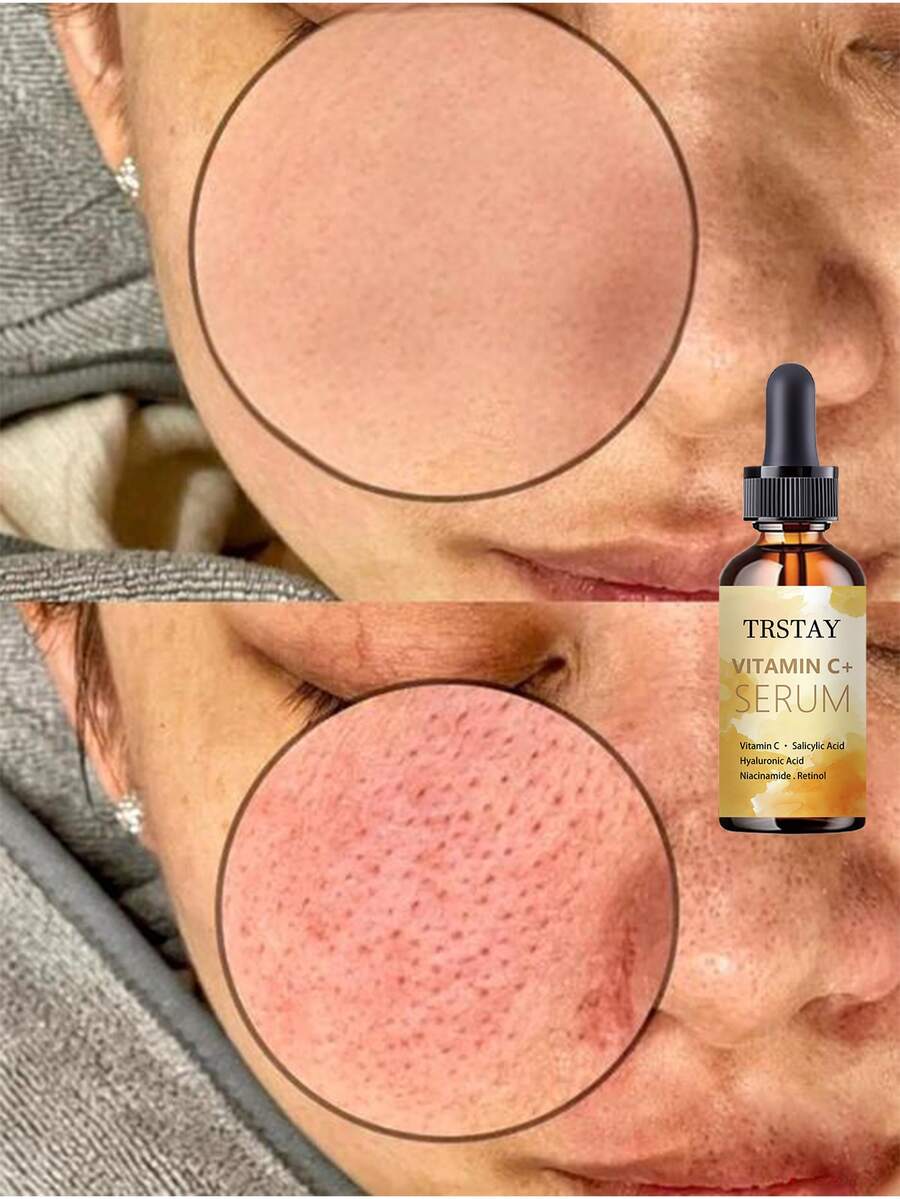 Oil Control Pore Minimizing Serum For Smooth Transparent Skin Regulate Oil Secretion Hide Rough Pores Instantly Brighten Even Skin Tone Whitening Facial Treatment For Radiant Glow With Natural Extracts - Nhiều màu - Xem 1