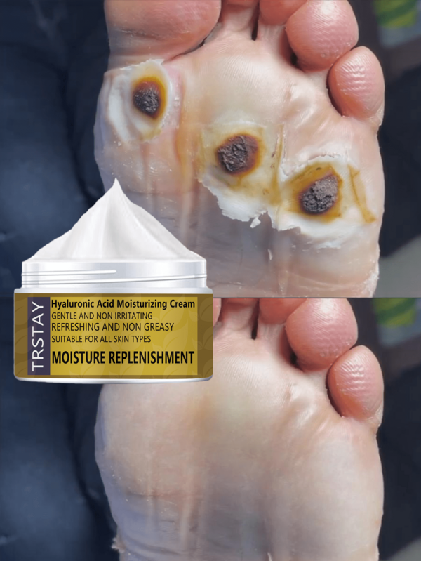 Moisturizing Foot Cream For Dry Cracked Heels Deeply Hydrates Repairs Rough Skin Softens Soles Prevents Moisture Loss Enriched With Natural Extracts Revitalizes Tired Feet Leaves Smooth Refreshed
