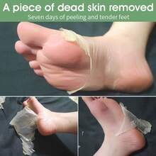 4pcs Foot Exfoliating Mask | Dermatologically Tested, Repairs And Exfoliates Heels, Dry And Dead Skin For Soft Feet | Exfoliating Foot Exfoliating Mask For Chapped Feet | Aloe Vera - trắng - Xem 3