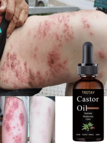 Organic Plant Based Deep Nourishing Body Oil For Dry Skin Essential Oils Hydration Moisturizes Brightens Improves Skin Texture Radiant Glow Natural Care Long Lasting Hydration Soothing Relief For Skin - 彩色 - 查看 1