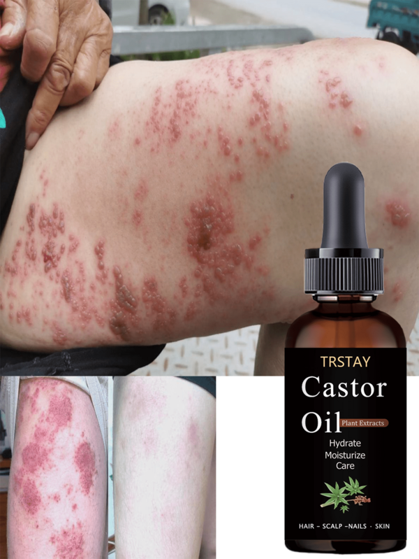 Organic Plant Based Deep Nourishing Body Oil For Dry Skin Essential Oils Hydration Moisturizes Brightens Improves Skin Texture Radiant Glow Natural Care Long Lasting Hydration Soothing Relief For Skin