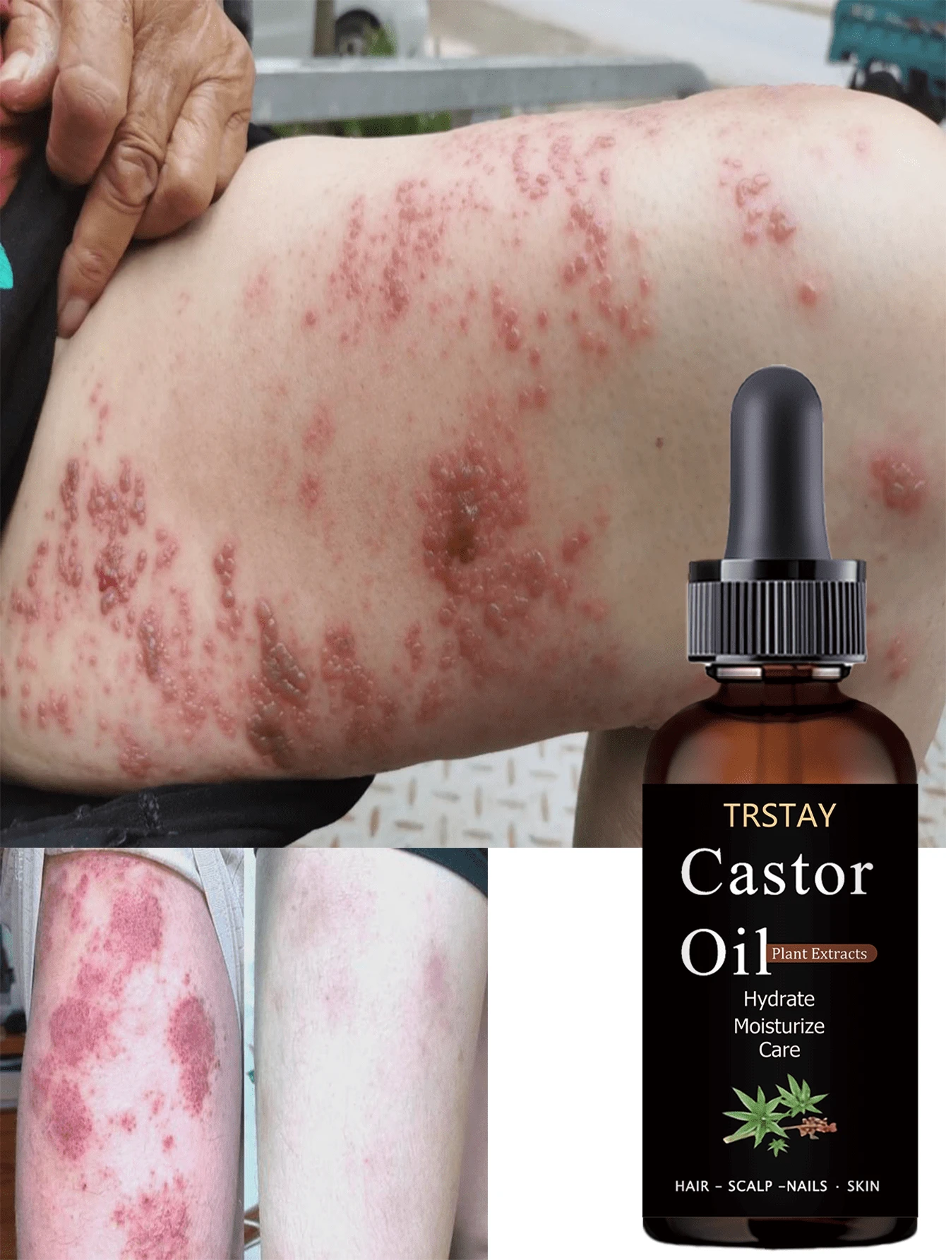 Organic Plant Based Deep Nourishing Body Oil For Dry Skin Essential Oils Hydration Moisturizes Brightens Improves Skin Texture Radiant Glow Natural Care Long Lasting Hydration Soothing Relief For Skin - 彩色 - 查看 1