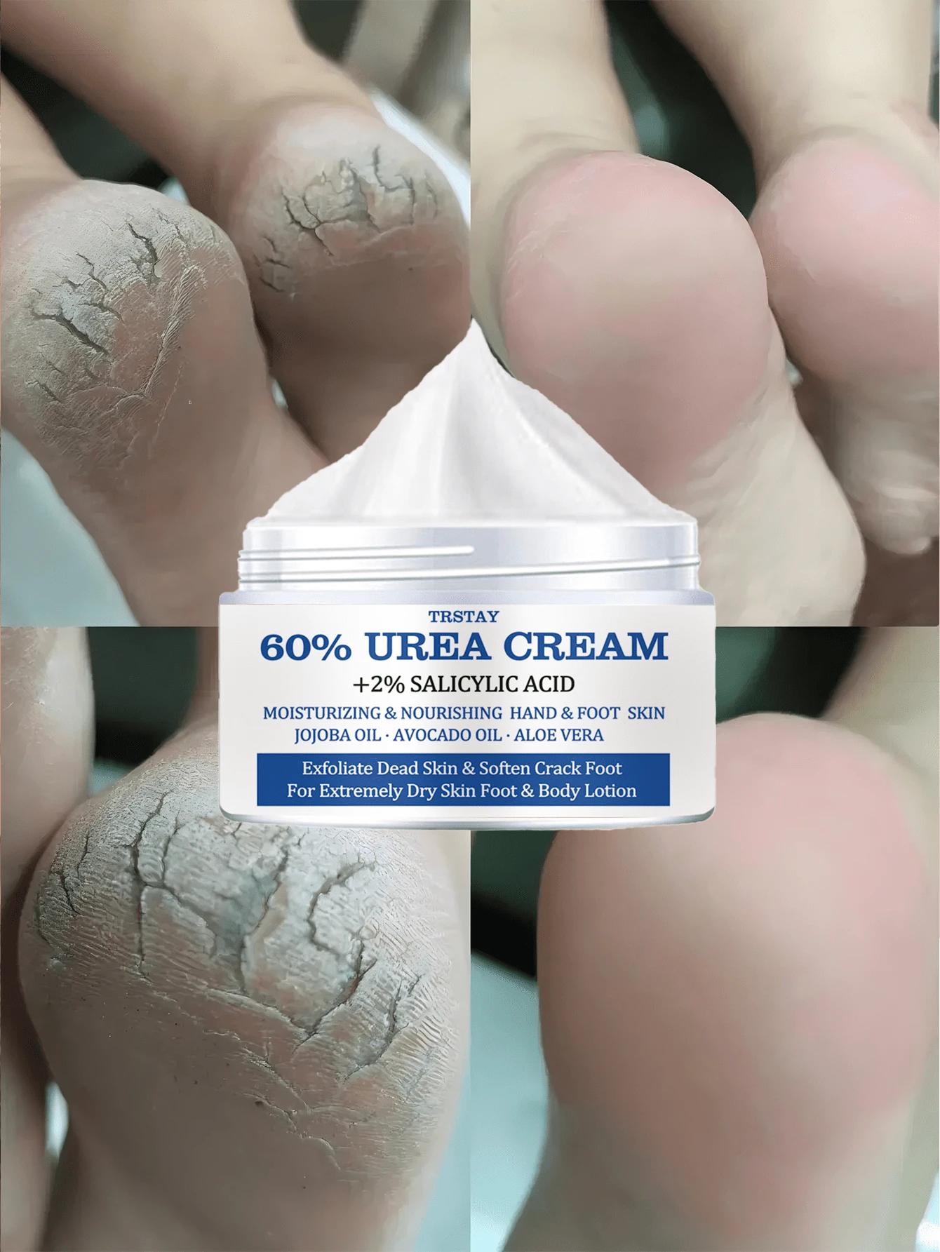 Deep Moisturizing Foot Cream Repairs Dry Cracked Heels Provides Long Lasting Hydration Softens Rough Skin On Soles For Smooth Soft Feet Enriched With Natural Extracts To Nourish And Revitalize Tired Feet Leaving Them Refreshed And Rejuvenated All Day - Multicolor - View 1