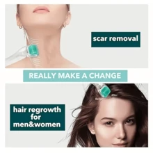 1pc Stainless Steel Leather Roller, 0.3 Mm Needle Length, Stainless Steel And Plastic, Fragrance-Free, Manual For Skin, Beard And Hair Care.