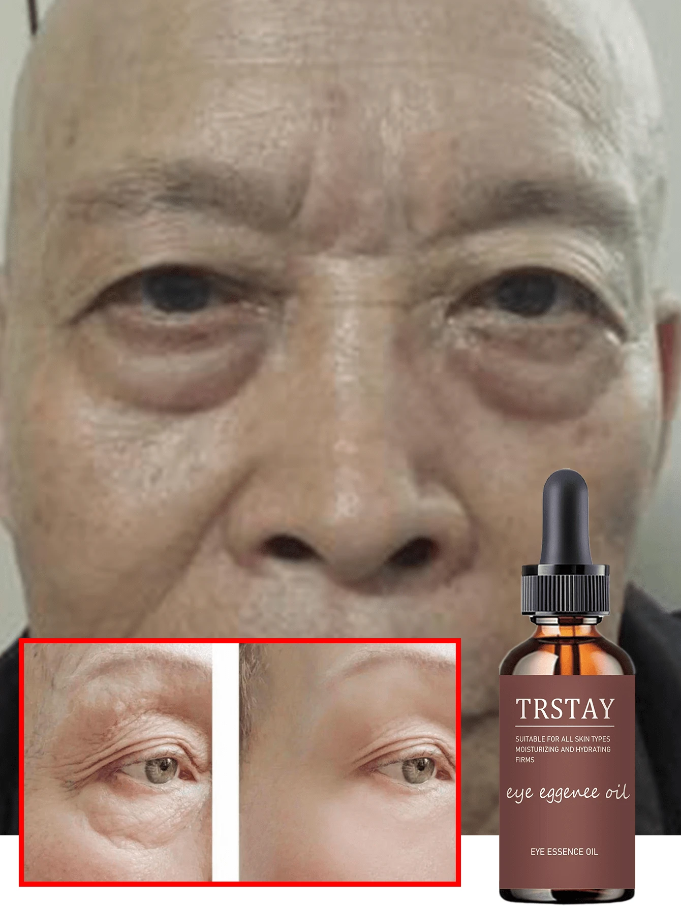 Brightening Anti Aging Eye Care Essential Oil For Glowing Skin Hydrating Nourishing Eye Oil For Even Tone And Dark Circle Treatment Revitalizing Under Eye Serum Reduces Puffiness And Fine Lines With Natural Ingredients For Youthful Appearance All Skin Types - Nhiều màu - Xem 1