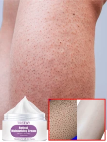 Vitamin E Body Cream With Shea Butter And Aloe Vera For Brightening Softening Skin Deep Hydration And Ultimate Moisturization Long Lasting Nourishment Perfect For Dry Sensitive Skin Suitable For All Skin Types - 彩色 - 查看 2