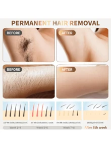 Dispositivo indoloro de eliminación de vello por IPL para uso doméstico,dispositivo de depilación láser,depiladora portátil móvil,depiladoras Permanente para hombres y mujeres,dispositivo de depilación doméstico,eliminador de vello duradero - Rosa Fucsia - Ver 4