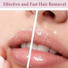 Women's Electric Facial Hair Remover, Painless Hair Removal Device For Lips, Body, Arms, Chin, Wireless, USB Rechargeable, Compact & Easy To Use, With LED Light, Women's Body Hair Trimmer - Multicolor - View 5