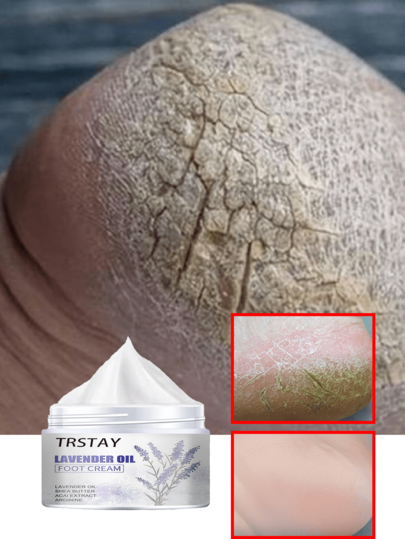 Foot Cream With Shea Butter And Vitamin E For Dry Cracked Heels And Rough Skin Deep Hydration Moisturizing Nourishing Care For Soft Smooth Feet All Day Long