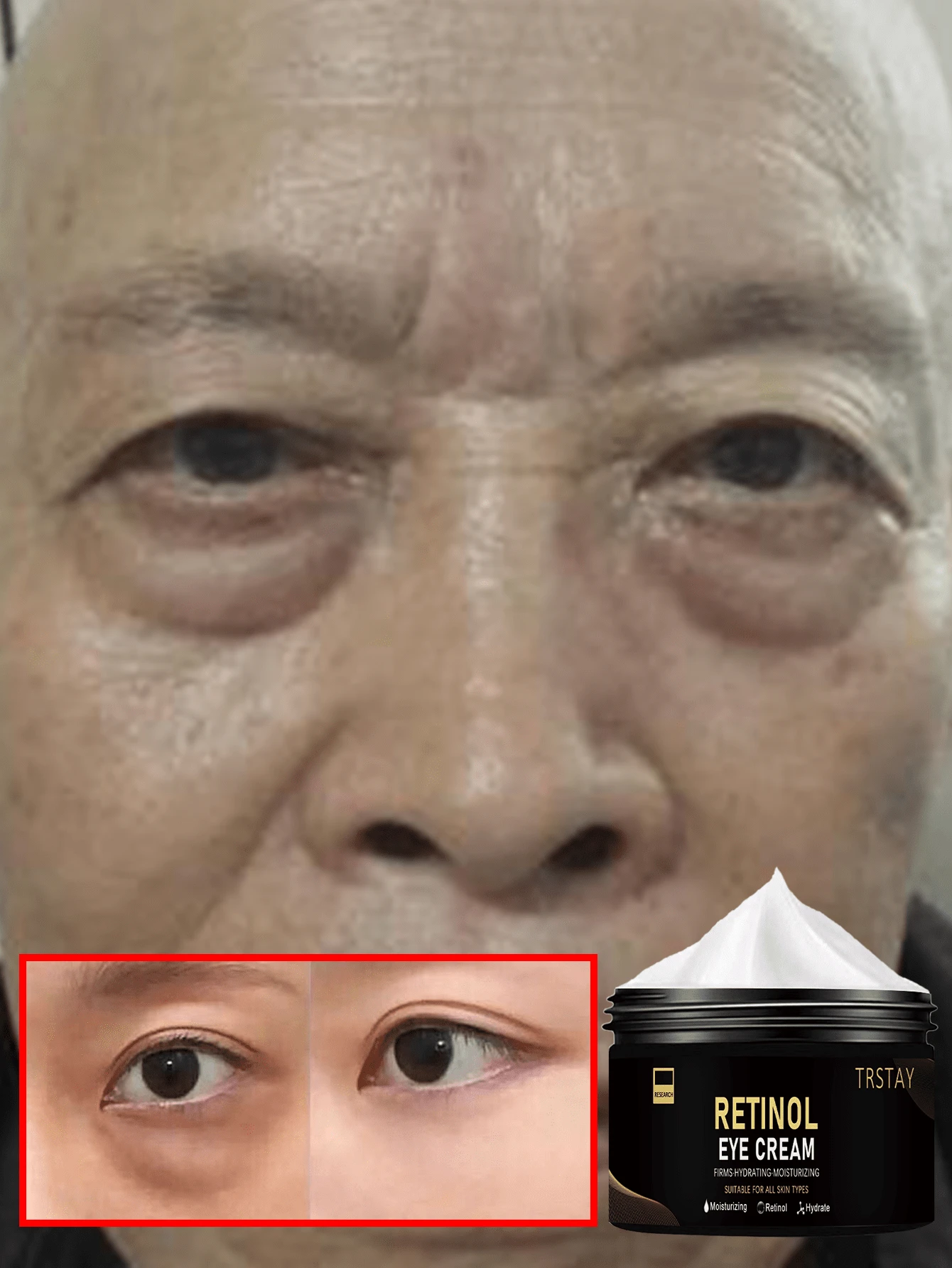 Anti Aging Eye Cream With Collagen Treatment Reduce Dark Circles Eye Bags Wrinkles Fine Lines Brightening Hydrating Lift Firm Repair Under Eye Care Essence For All Skin Women Men - 彩色 - 查看 1