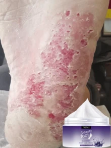 Natural Extracts Foot Cream Deeply Hydrates Repairs Cracked Heels Softens Rough Skin Long Lasting Moisture Revitalizes Tired Feet For Smooth Soft Feet All Day Enriched Formula Nourishes And Protects - Nhiều màu - Xem 2