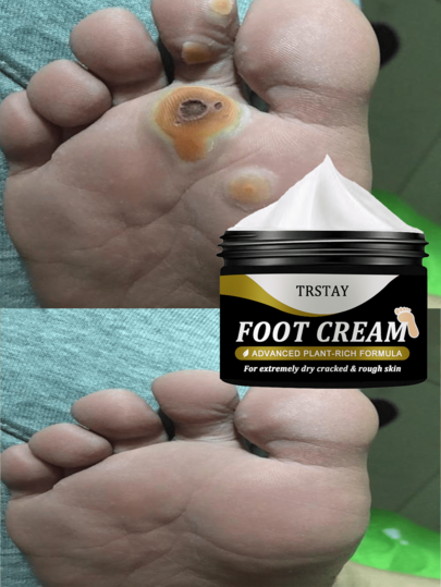 Nourishing Foot Care Cream For Softening Hard Calluses And Moisturizing Dry Feet Delicate Skin On The Back Of The Feet Confidence Secrets For Bare Feet Whitening And Smoothing Foot Treatment For Cracked Heels And Rough Skin Intensive Hydration And Repair Formula For Soft And Healthy Feet