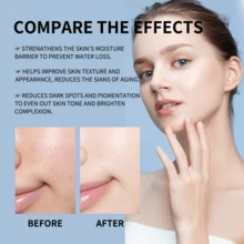 Humectante facial de Centella Asiática, que contiene menta y propilenglicol, para el tratamiento del acné | Contiene niacinamida y pantenol para calmar, reparar y hidratar la piel, ofreciendo beneficios hidratantes, antiarrugas, antienvejecimiento y reductores de líneas finas (100ml/3.38 Fl Oz). Esta crema facial diaria es compacta y portátil, adecuada para todo tipo de pieles.