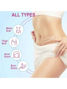 1 pieza Cinta de silicona para cicatrices quirúrgicas - Cinta para cicatrices médica de grado para arrugas, cicatrices quirúrgicas, cicatrices queloides y cicatrices hipertróficas - Hojas reutilizables de cinta para cicatrices - Marrón - Ver 3