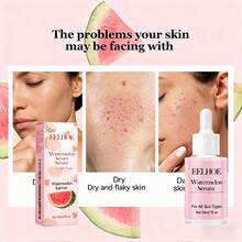 EELHOE Watermelon Nicotinamide Facial Serum - & Brightening Face Essence With Vitamin C, Fragrance-Free For All Light Beige Types, Skincare Routine, Sleek Bottle Design, Niacinamide Serum - 粉色 - 查看 2