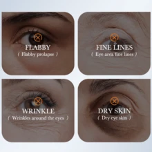 Snail Collagen Eye Mask, Fades Fine Lines, Dark Circles And Puffiness, Moisturizes And Nourishes Eye Care - Multicolor - View 3