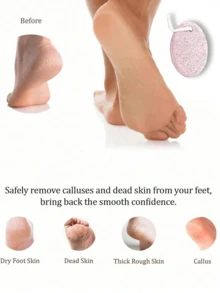 Bộ 2 dụng cụ chăm sóc chân tái sử dụng - Dễ sử dụng hơn - Bề mặt mài rộng hơn và tiện lợi hơn, dụng cụ tẩy tế bào chết da chân, đá mài, chăm sóc chai sần, tẩy tế bào chết, chăm sóc da cứng, dụng cụ mài và cắt móng chân, sản phẩm spa chân, dụng cụ chăm sóc và tỉa móng chân, chăm sóc chân, thiết kế hai mặt, có thể sử dụng ở hai bên, mu bàn chân và gót chân, có tay cầm để dễ dàng sử dụng, phù hợp cho nam, nữ, phòng tắm, phòng ngủ và bãi biển. - Nhiều màu - Xem 9