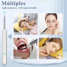 Limpiador Oídos Espiral Con Cámara Endoscopio, Quita Cerilla - Blanco y Negro - Ver 7