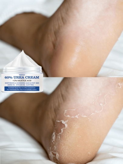 Moisturizing Foot Cream For Dry Cracked Heels And Rough Skin Long Lasting Hydration Softens Soles For Smooth Feet Enriched With Natural Extracts To Nourish And Revitalize Tired Feet