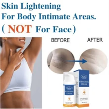 Skin Bleaching Cream, Dark Spot Remover For Face, Intimate Areas & Body, Vitamin C Whitening For Underarms, Knees, Elbows, Inner Thighs, Bikini Line – Sensitive Skin Lightening Cream - 彩色 - 查看 6
