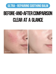 La Roche Posay Cicaplast B5+ 密集修护舒缓膏 15/40ml，皮肤科医生级修护受损肌肤，蕴含5%维生素B5、积雪草提取物和温泉水，有效舒缓肌肤，减少刺激，修复压力肌肤，并重建肌肤屏障。质地轻盈不油腻，快速吸收，适合所有肤质，尤其适合敏感肌或术后肌肤。完美适用于日常护理、季节性干燥和压力引起的泛红。 - 理膚泉B5修復乳霜 - 查看 3