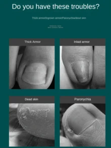 1pc Toenail Clipper, Nail Clipper, Professional Pedicure Tool - Multicolor - View 4