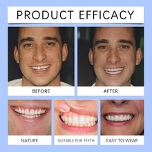 Denture And False Tooth Sets Enhance The Beauty Of Smiles. Comfortable Material Dentures And Dental Beauty Sets - 白色 - 查看 2